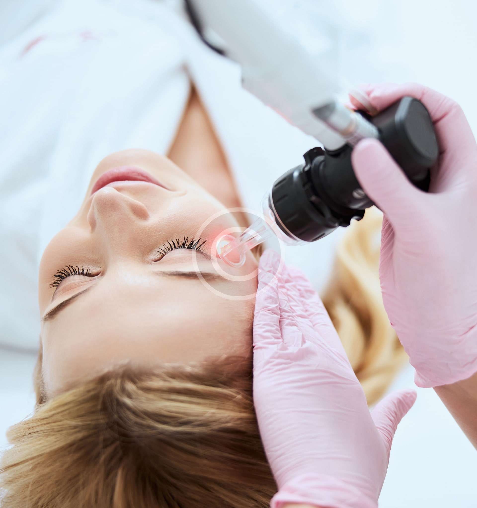 Pigment correction